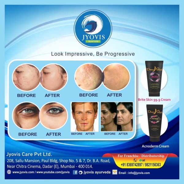 Brite 99.9 Cream | Lightens & Brightens Skin | Reduces Tan | Lightens Skin